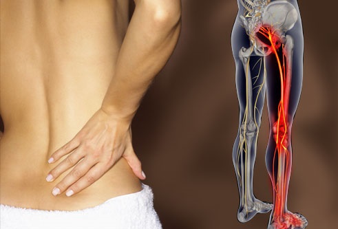4 типа боли в спине и упражнения, которые помогут избавиться от болезненных ощущений