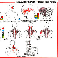 Болит шея с левой стороны: причины боли и что с этим делать
