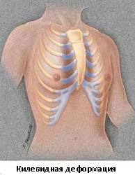 Липосакция для мужчин: живот и грудь - Christinas Clinic