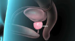 Лечение простатита (воспаление простаты) у мужчин