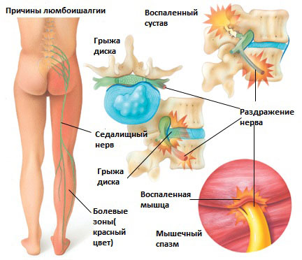 Боль от бедра до колена: причины, диагностика, лечение в Москве