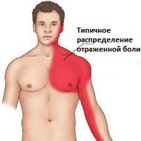 Боль в груди справа - причины, диагностика, лечение