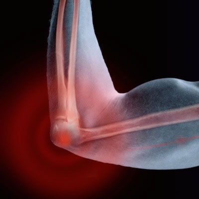 Боль в локтях рук - причины, методы лечения боли в локтевом суставе